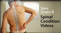 Spine Surgery & Spinal Condition Videos - Kraus Back & Neck Institute