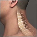 Spine Surgery - Kraus Back & Neck Institute