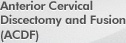 Anterior Cervical Disectomy and Fusion (ACDF) - Kraus Back & Neck Institute